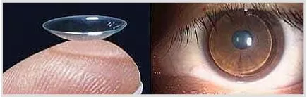 Contact Lens Fitting in Delhi