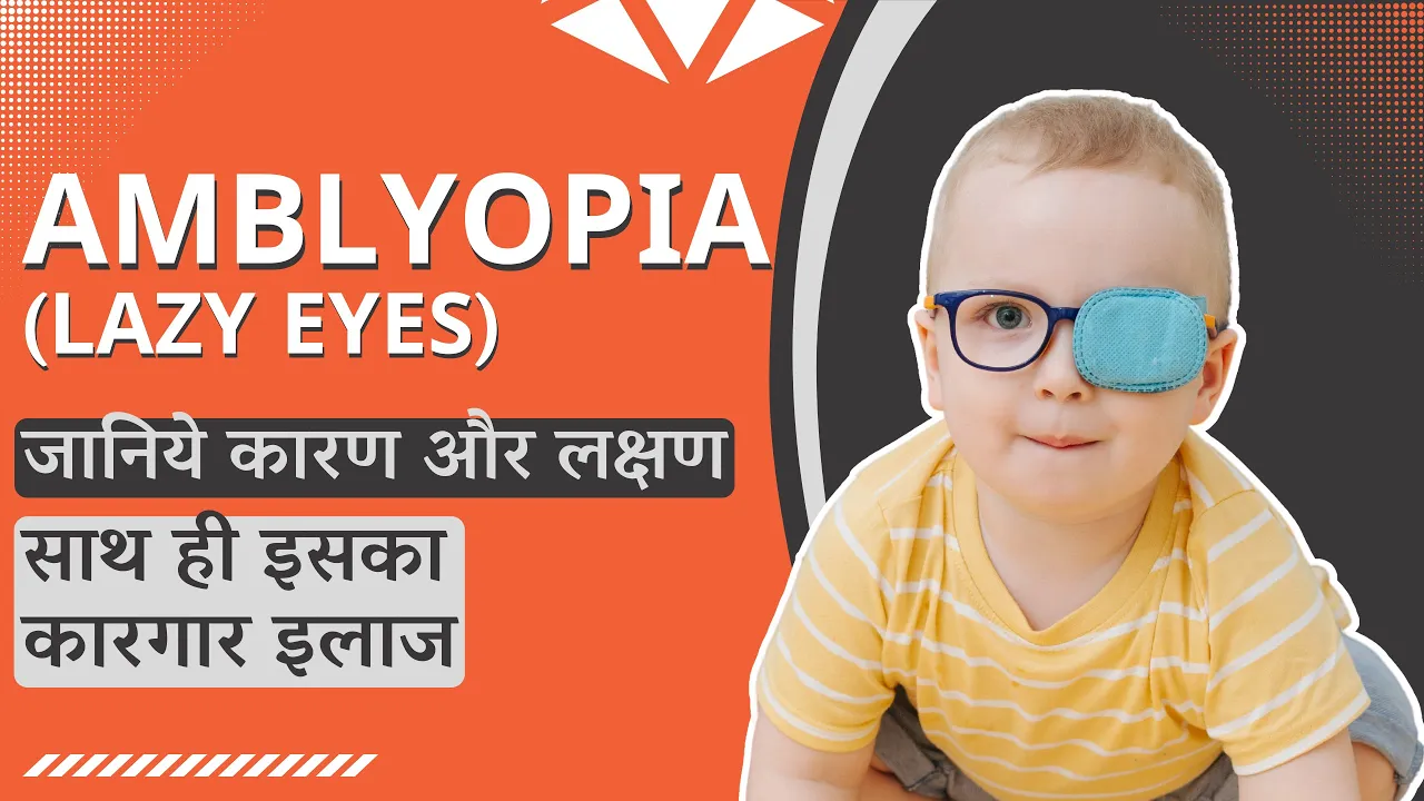 Amblyopia in Kids - Lazy Eyes Treatment in DelhiAmblyopia in kids ...