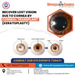 Corneal Transplantation at Shreya Eye centre