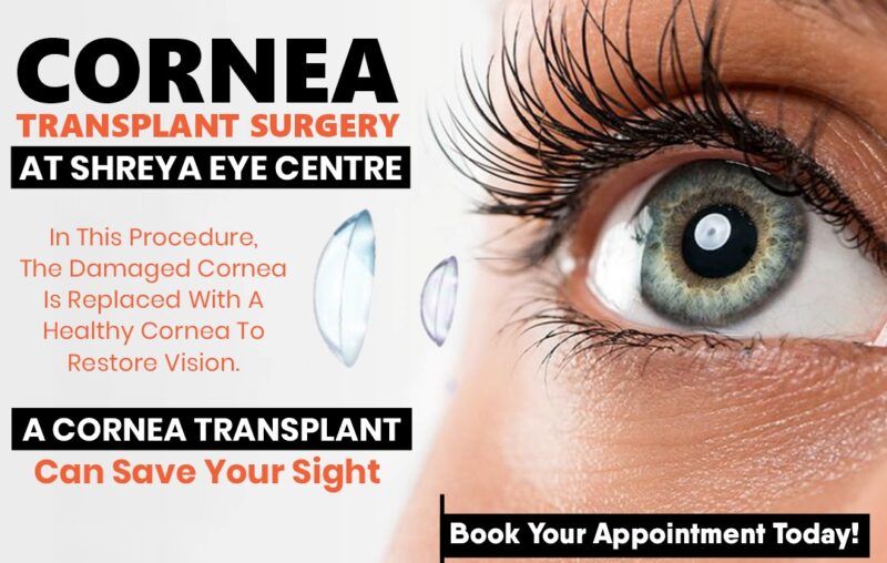 Cornea Transplant